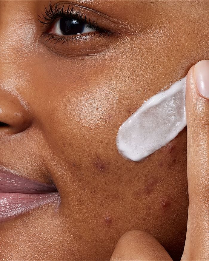 CeraVe Acne Foaming Cream Cleanser Benzoyl Peroxide 4% Face Wash - Ultalish