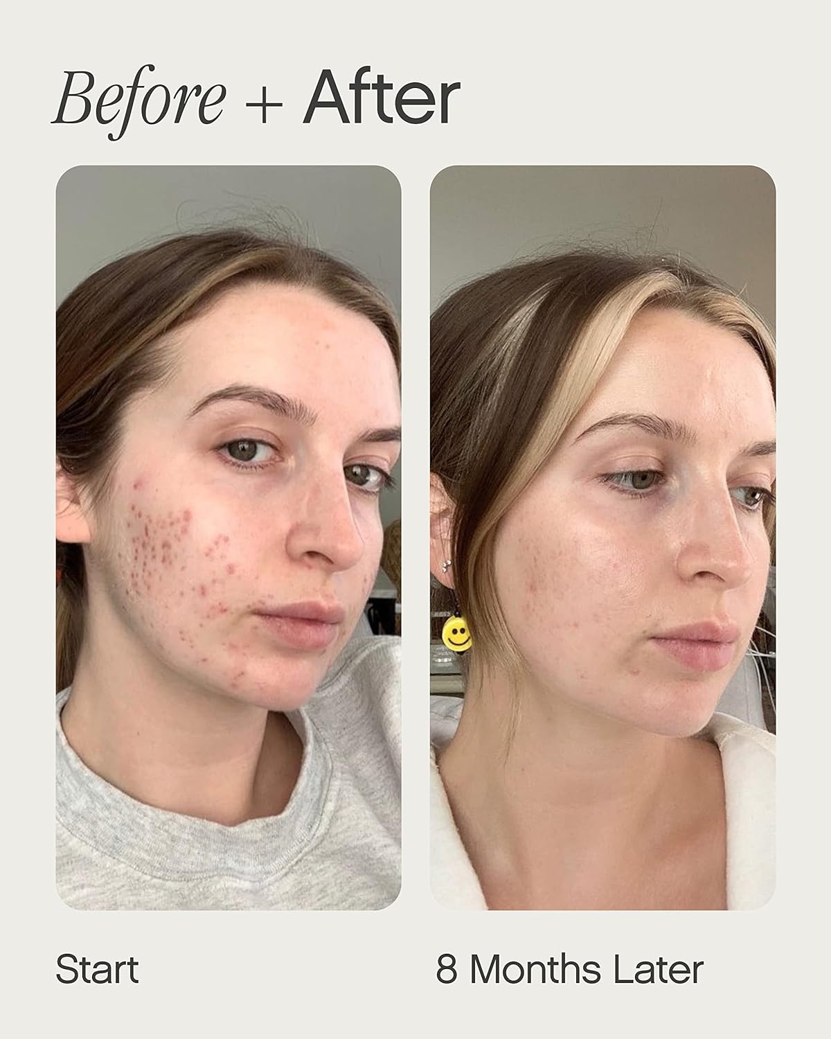 Topicals Mini Faded Skin Serum voor donkere vlekken en verkleuring - Hyperpigmentatie - Tranexaminezuur en Niacinamide - littekens en vlekken - 15ml - Ultalish